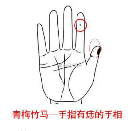 左手食指痣相图解图片