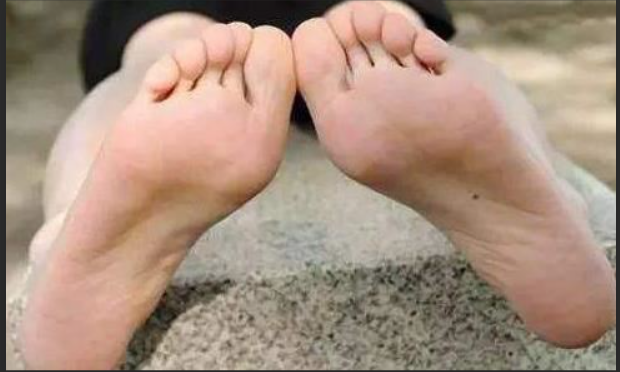 右脚脚底有痣的女人代表什么 女人右脚底长痣代表什么命运
